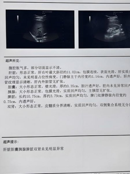 肝脏常见疾病的超声诊断 - 相关描述