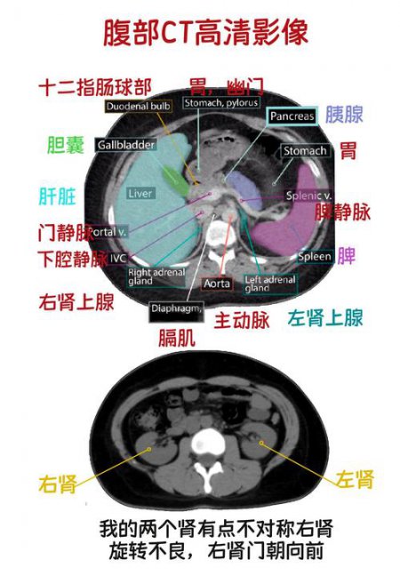 腹部影像学