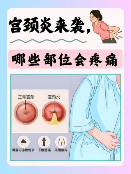 零基础入门秦博妇科超声诊断（共80讲） - 相关描述