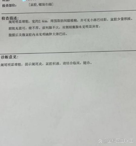 腹部疾病诊断
