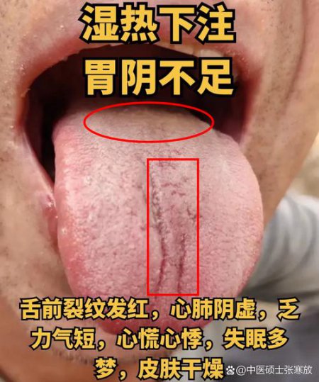 舌诊案例