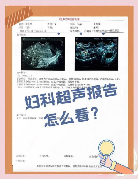 零基础入门秦博妇科超声诊断（共80讲） - 相关描述