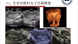零基础入门秦博妇科超声诊断